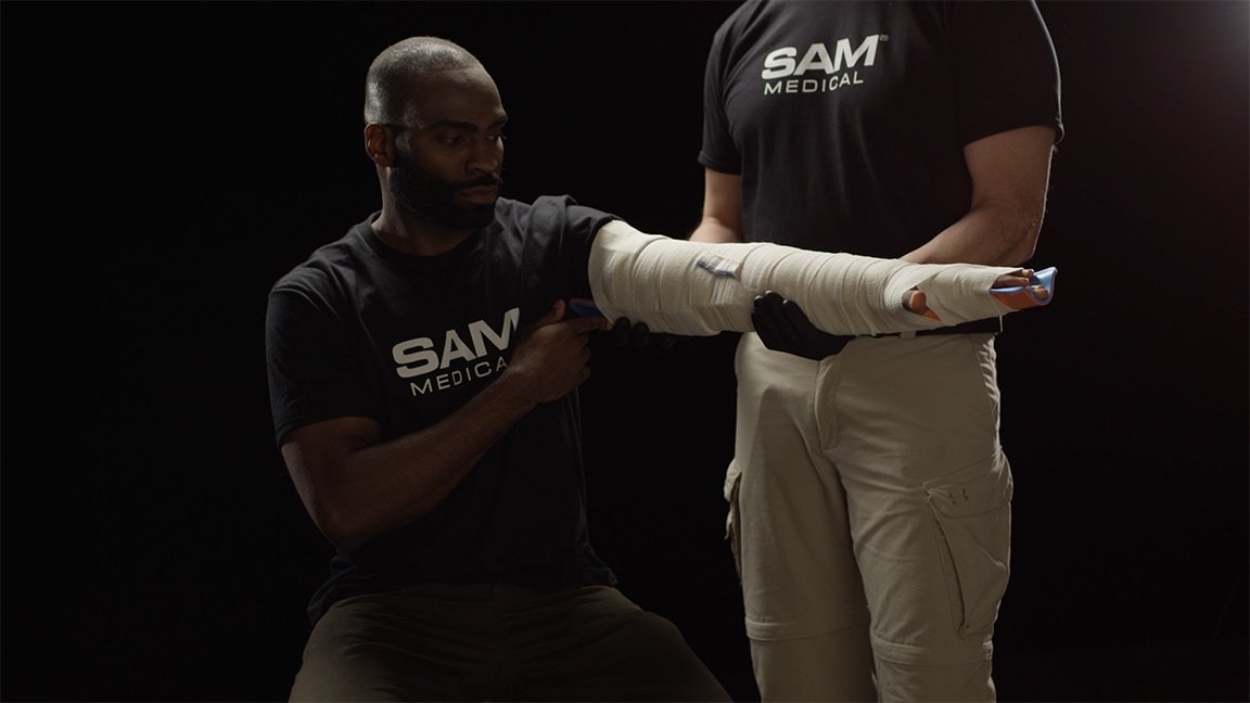 Sam Training Sam Splint Dislocated Elbow Final